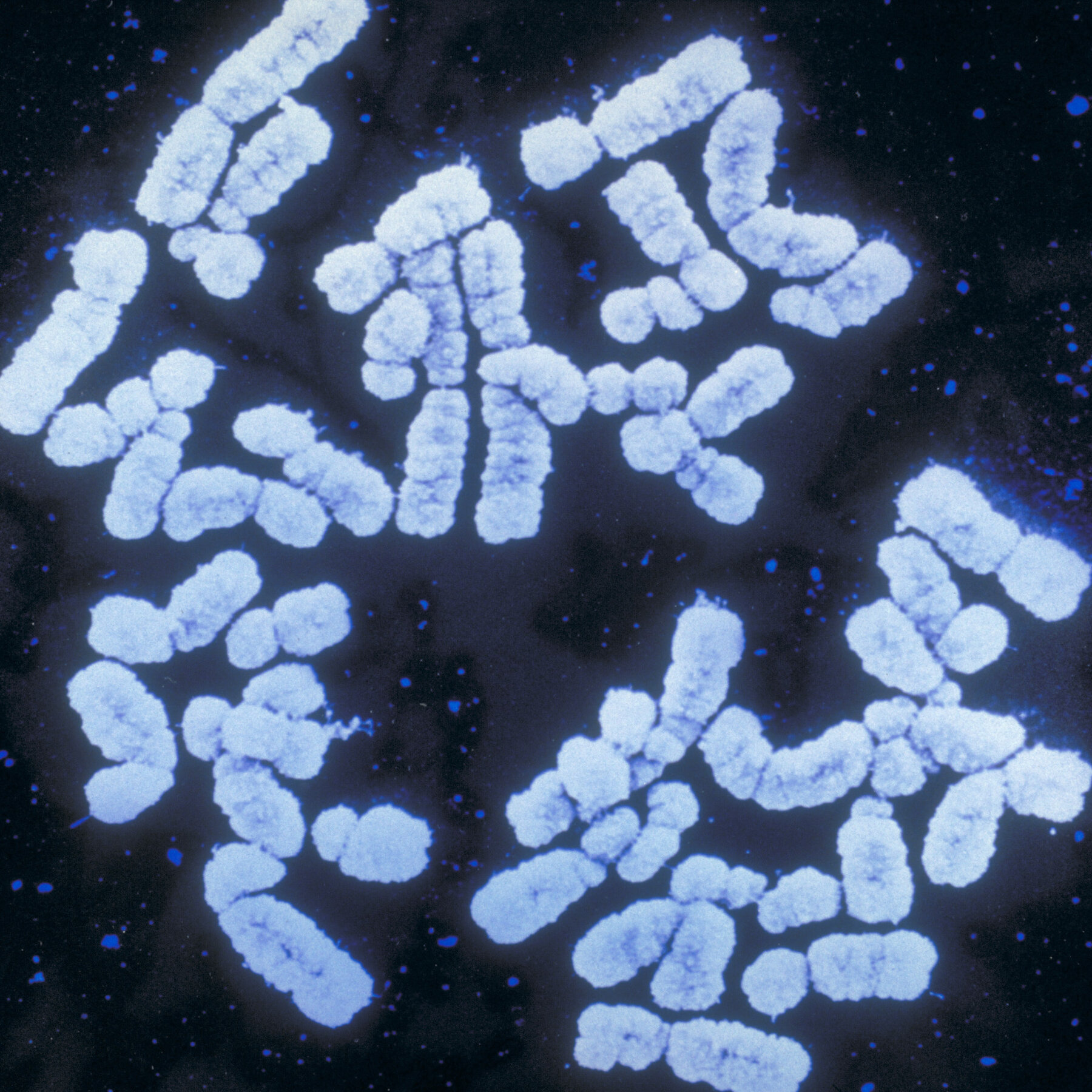 You are currently viewing Genetic Scores are Booming. But Will Anti-Discrimination Laws Cover Your DNA?