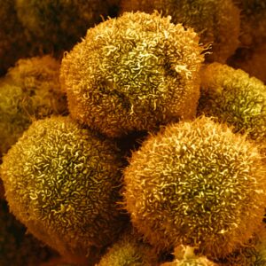 Read more about the article New Drug Approved by F.D.A. for Pancreatic Cancer Could Be First of Many